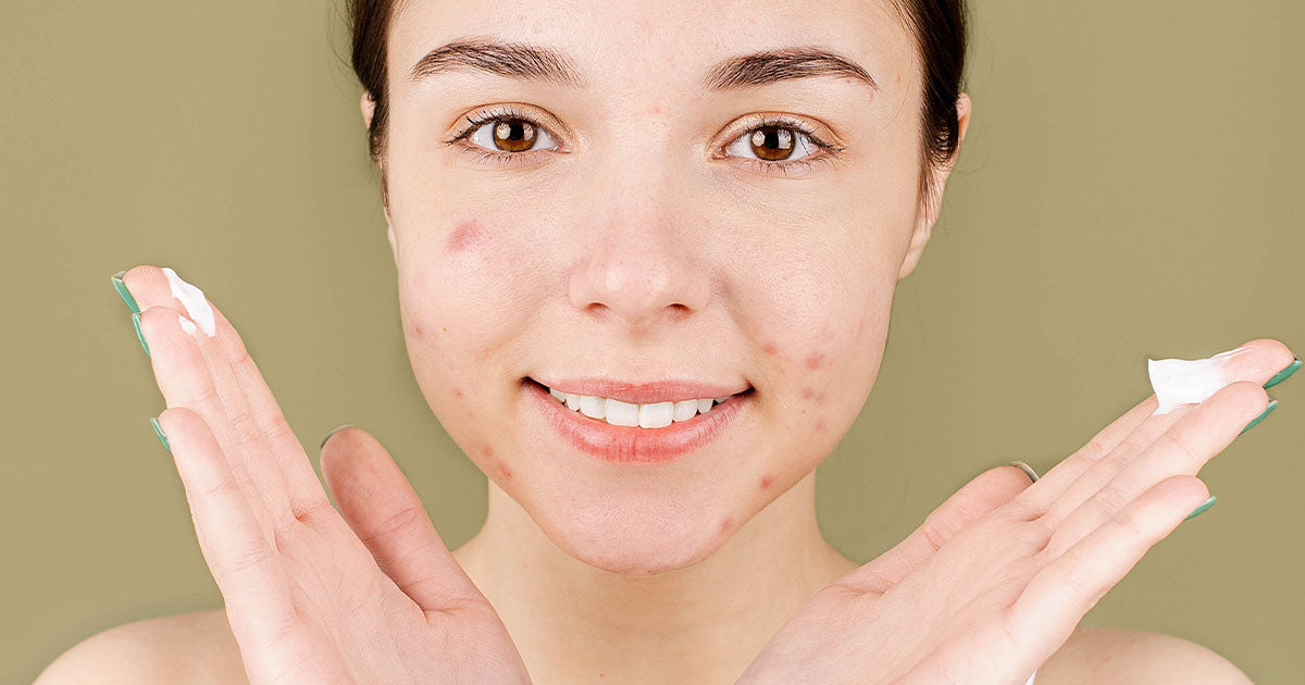 Acne during online period