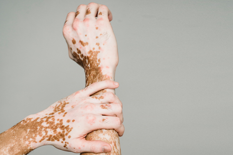 What does it take to be Body Positive?