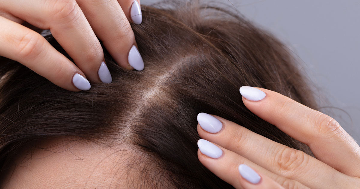 Why Is My Hair Thinning and How to Stop It?