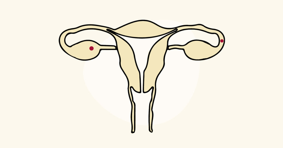 What is Hyperovulation? - Causes, Signs of Hyperovulation, Supplements