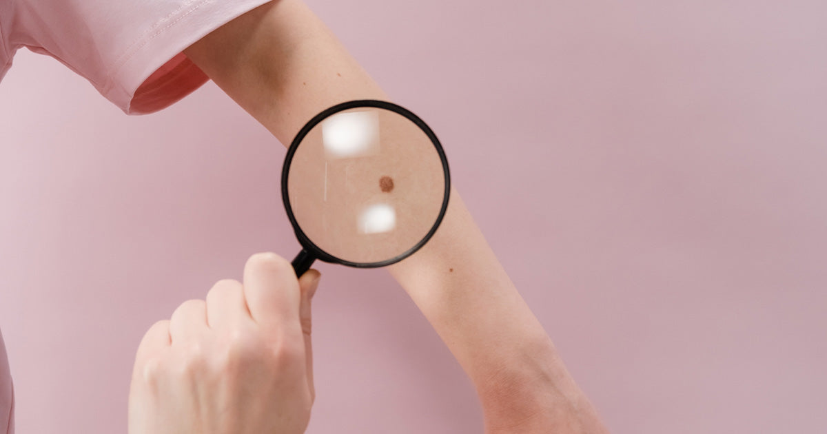 10 Reasons to See a Dermatologist and Why it is Important