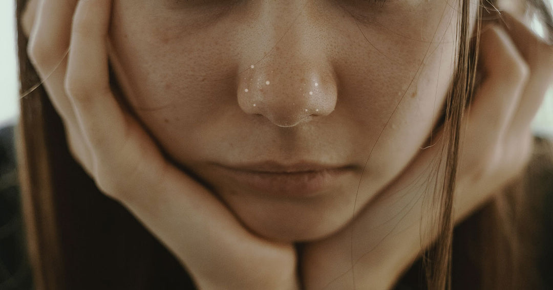 Whitehead: Causes, How do you get rid of whiteheads?