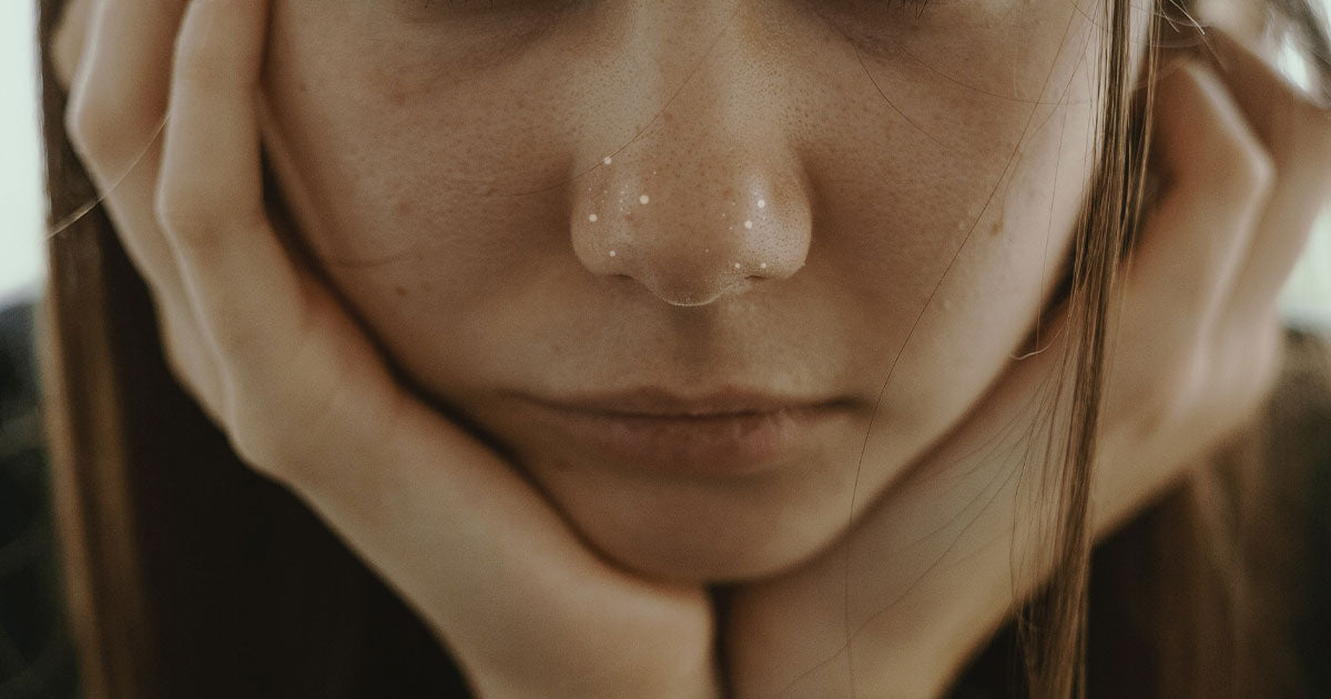 Whitehead: Causes, How do you get rid of whiteheads?