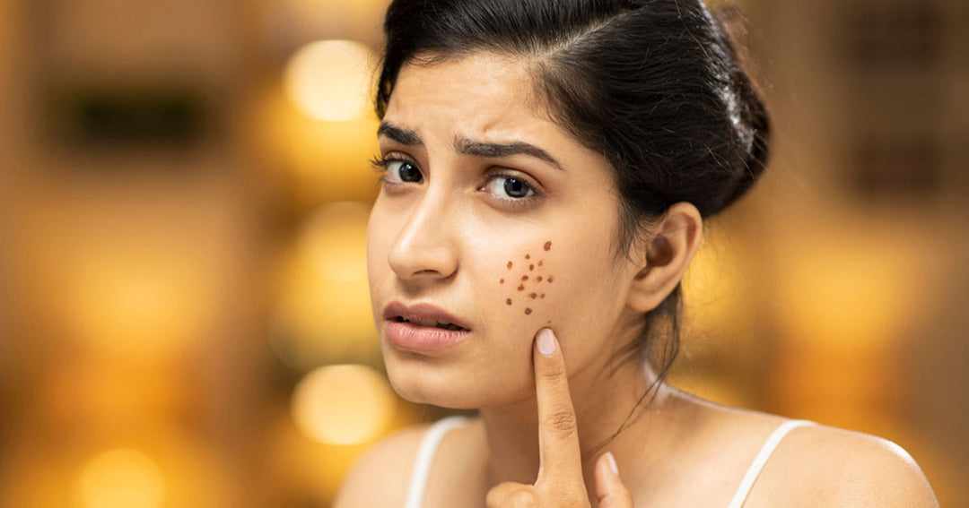 10 Warning Signs You May Have a Hormonal Imbalance