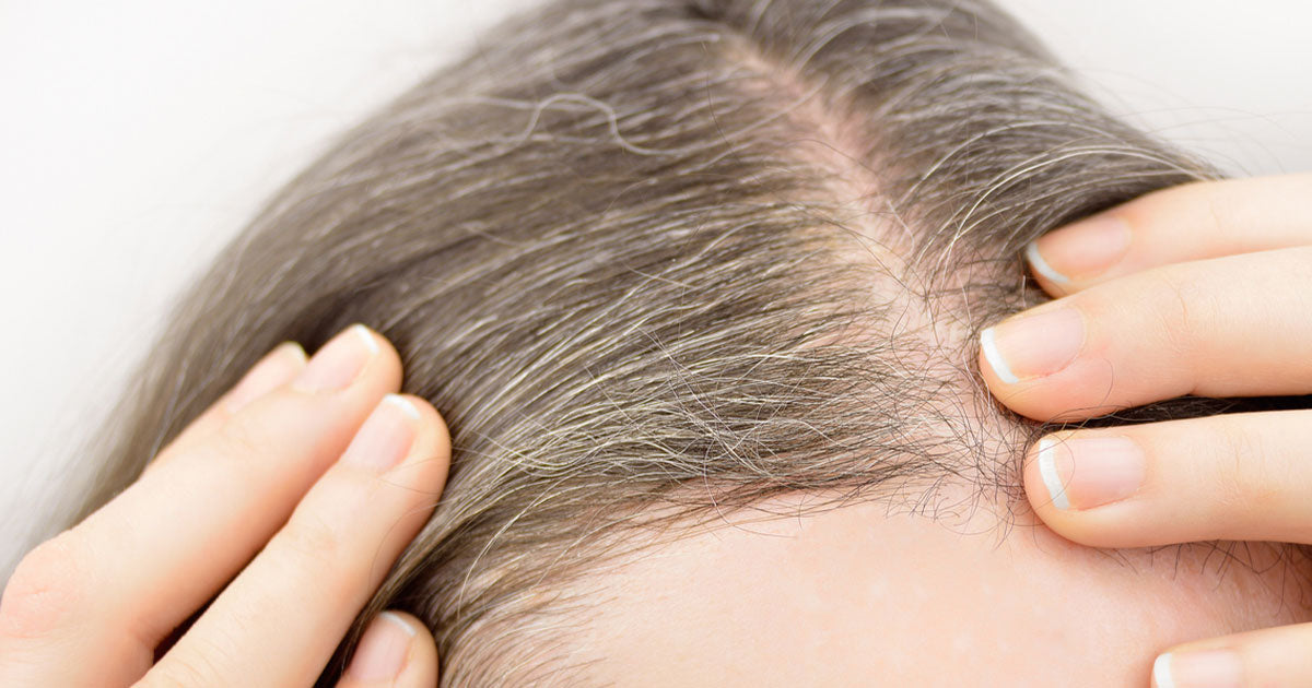 Reverse Grey Hair: 16 Nutrients, Vitamins, Mineral and Other Dietary Supplements