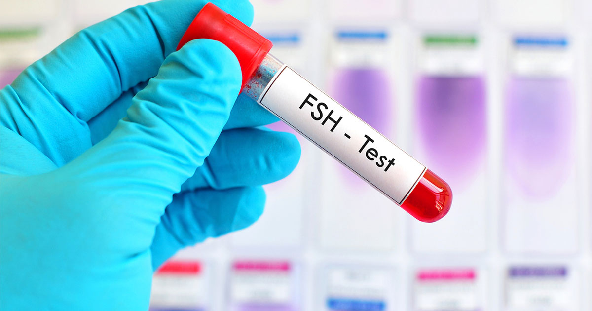 follicule-stimulating hormone (FSH)