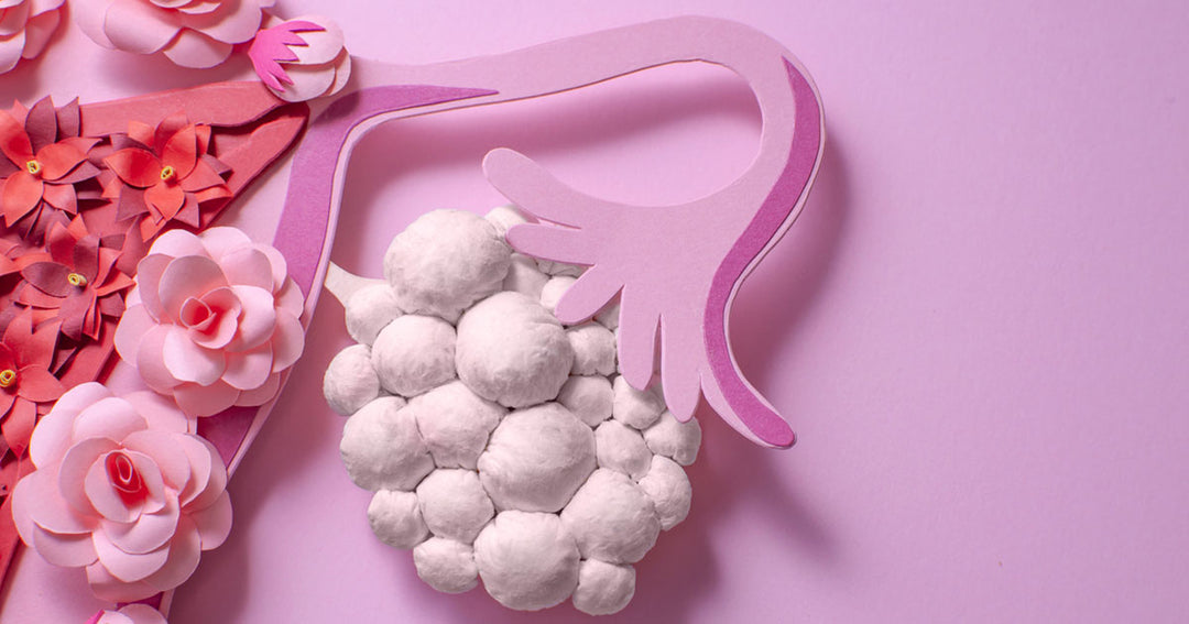 Polycystic Ovary Syndrome (PCOS): Symptoms, Causes, Effects and Treatment