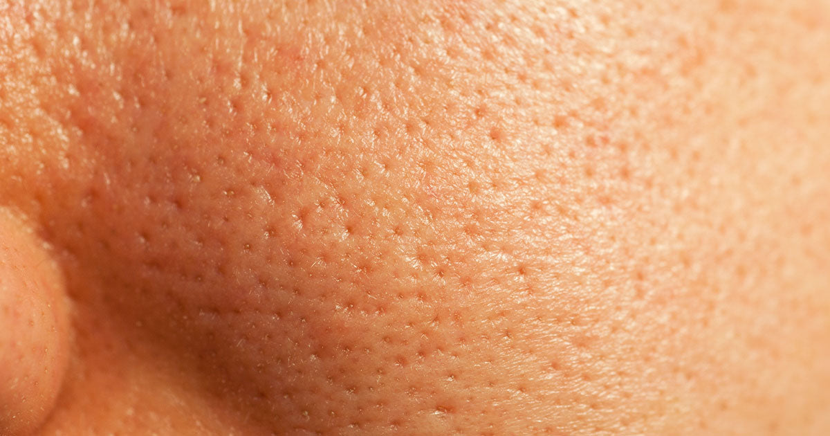 How To Minimize Pores 12 Different Ways: 10 Proven Tips to Shrink pores