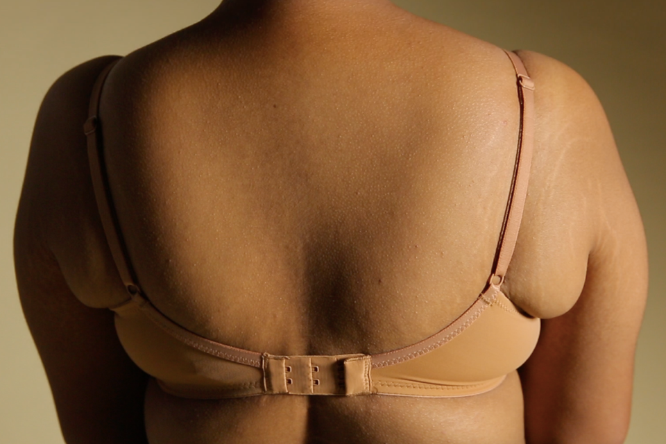 Imperfections