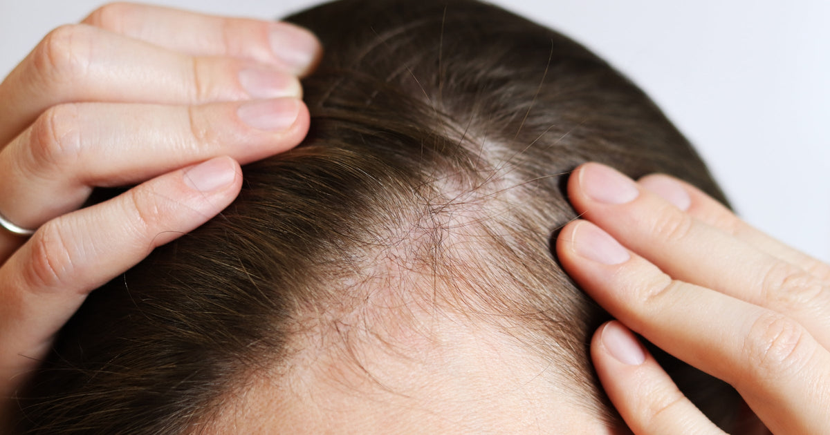 Body Hair and Hormones: PCOS, Pregnancy, Menopause Effects on Hair Growth