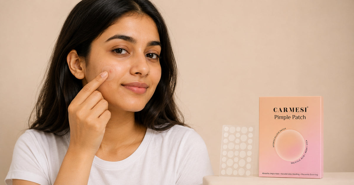Can You Put a Pimple Patch on a Popped Pimple? What Actually Happens and the Right Way to Do It