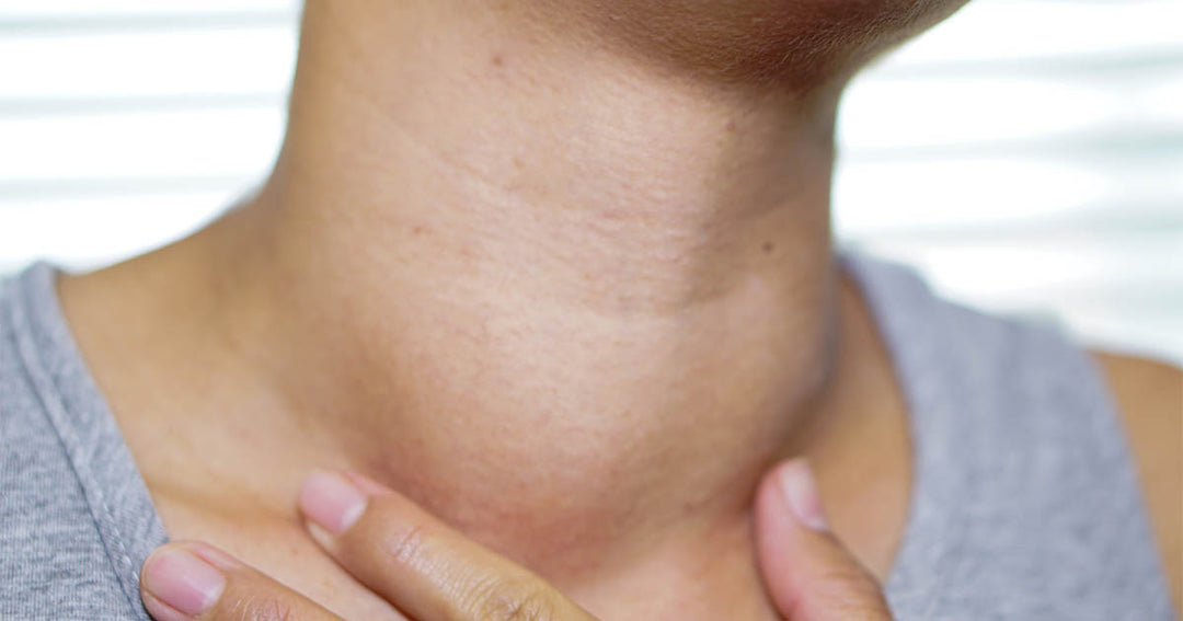 Symptoms of Iodine Deficiency