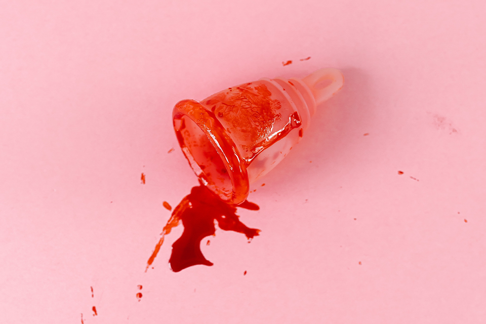 What is Menorrhagia?