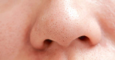 Tips for Cleaning and Unclogging Nose Pores