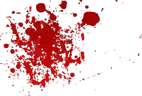 Menorrhagia or heavy bleeding during periods