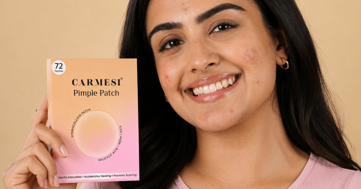 Pimple Patches in Monsoon: Does Humidity Affect How Well They Work and Stick?