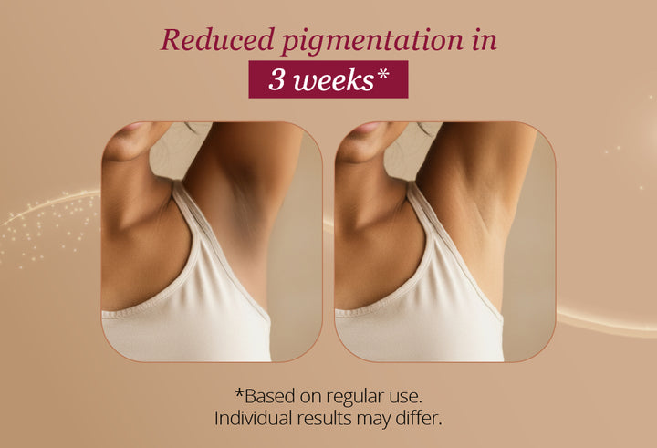 Restore Underarm Spray