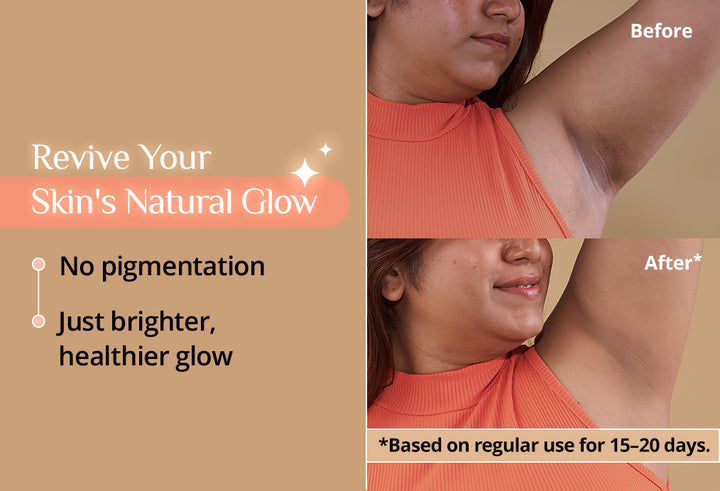 Self-Care Kit - Glow Revive Roll-on Deodorant, Wax Strips, Panty Liners, Air Feel Pads, Tote Bag