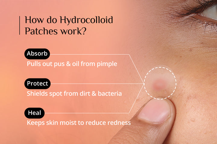 Carmesi Pimple Patch