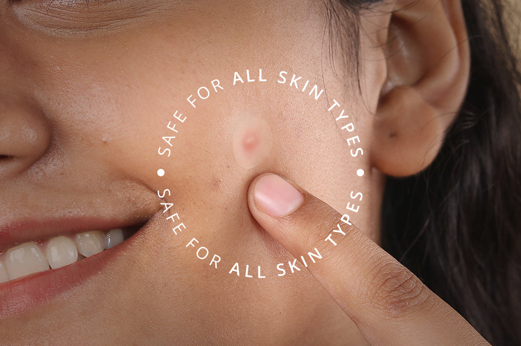 Carmesi Pimple Patch