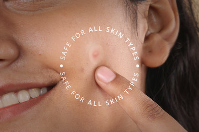 Carmesi Pimple Patch